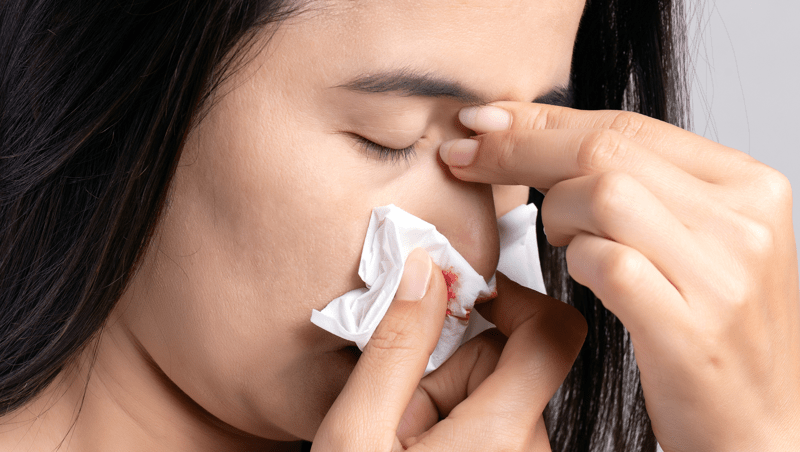 When To Worry About a Nosebleed: Is It Serious?