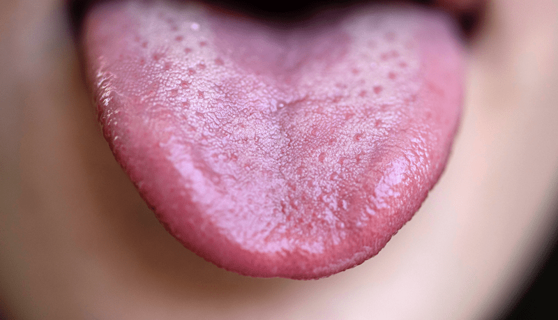 Metallic Taste In Your Mouth: 9 Common Causes