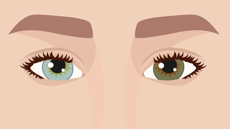 glutathione eye drops eye color change Yes, Your Eyes Can Change Colors — and Here's Why