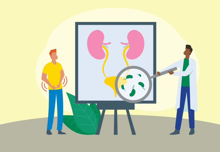 Link Between UTIs and Sex