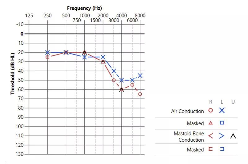 Audiology test