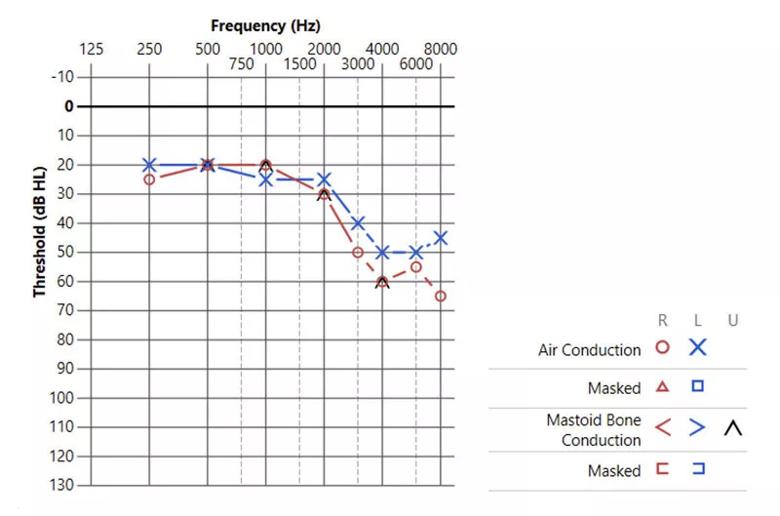 Audiology test