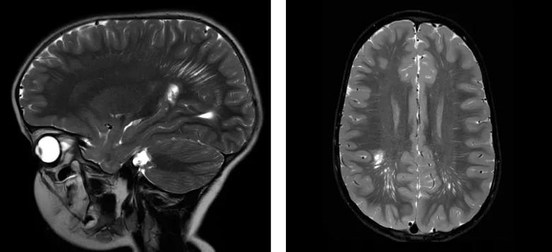 Sagittal and axial T2-weighted images.