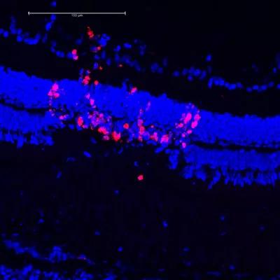 16-eye-2651-regeneration-cqd-inset-1