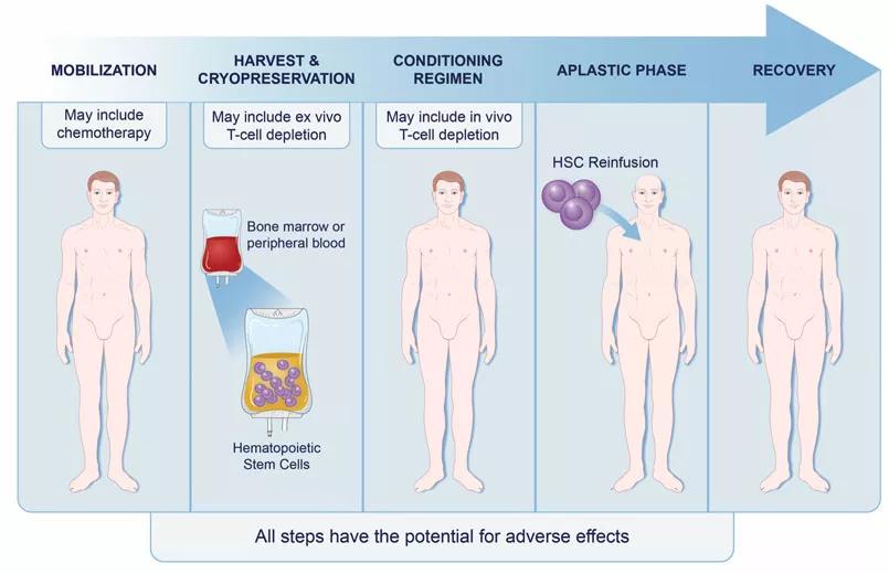 immunoablation followed by autologous hematopoietic stem cell transplantation for relapsing multiple sclerosis