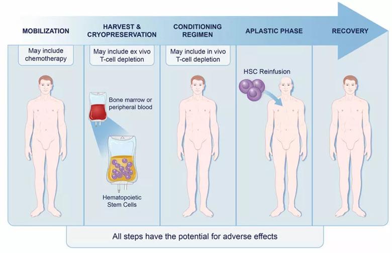 immunoablation followed by autologous hematopoietic stem cell transplantation for relapsing multiple sclerosis