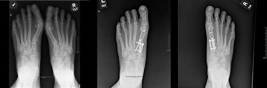 X-rays