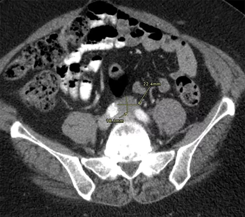 xray