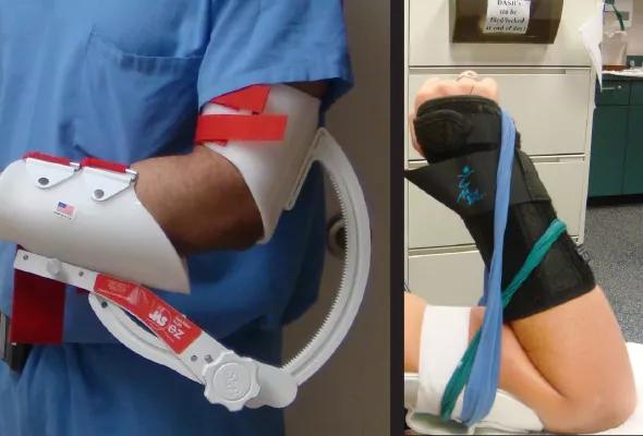 Figure 2. Static progressive elbow splint (left) and dynamic elbow splint (right).