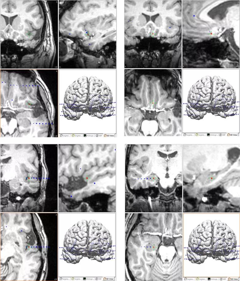 Inset Fig-4c