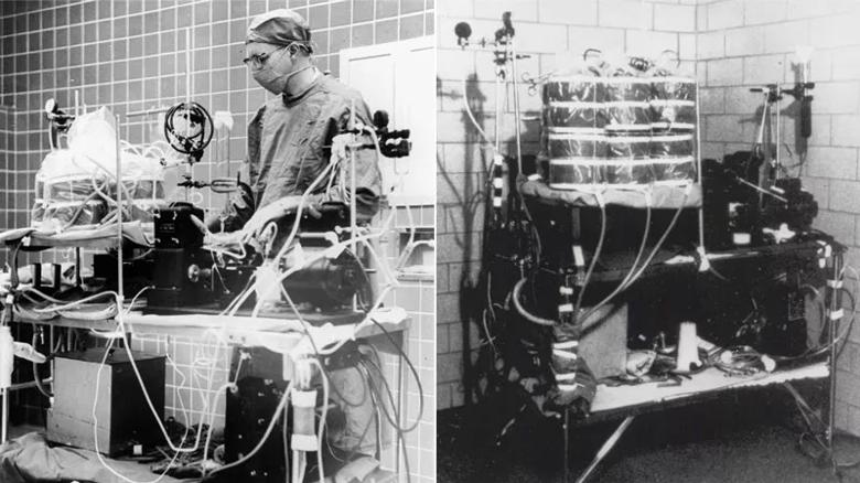 photo of early heart-lung machine