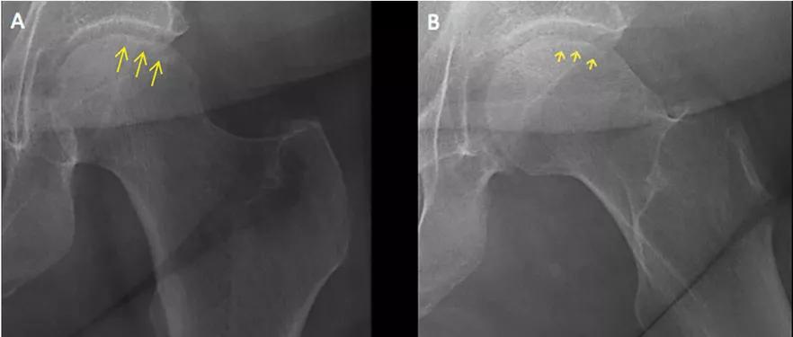 X-ray