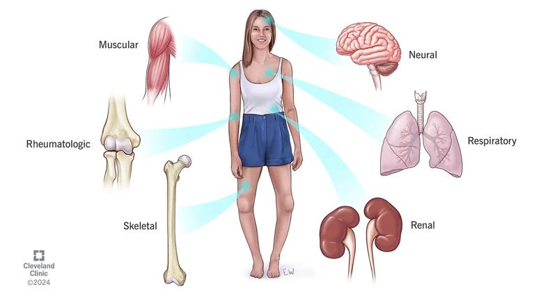 Illustration of systems that can be affected by hypophosphatasia