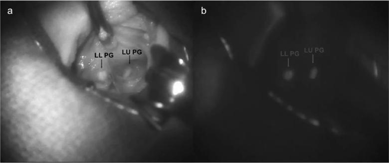 Intraoperative photos