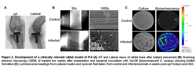 Periprosthetic joint infection