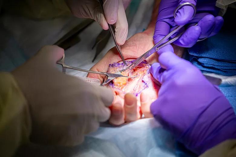 Gloved hands with surgical tools working on a dissected hand