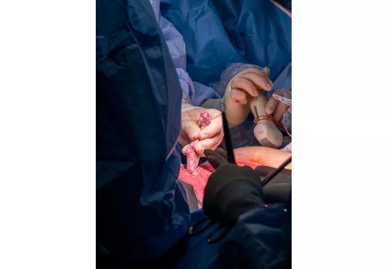 Pediatric cardiologist Dr. Francine Erenberg operates the echocardiogram transducer as Dr. Cass positions the fetus.