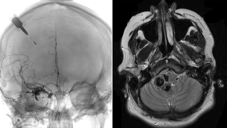 Cleveland-Clinic-Brain-Scans