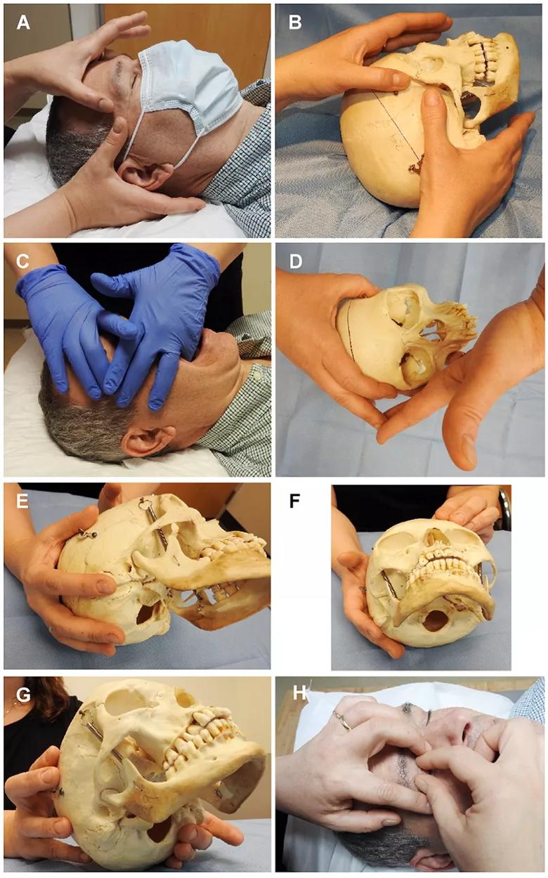 Osteopathic manipulation for Graves' disease