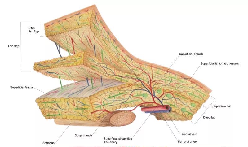 Microsurgery