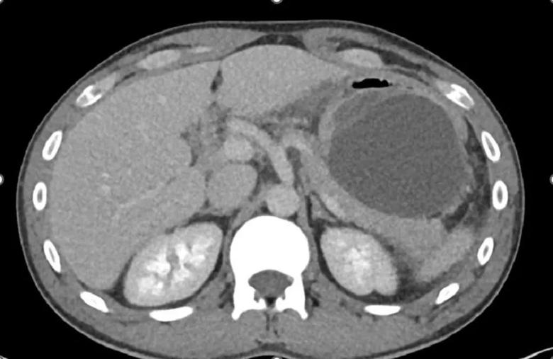 Repeat CT image.