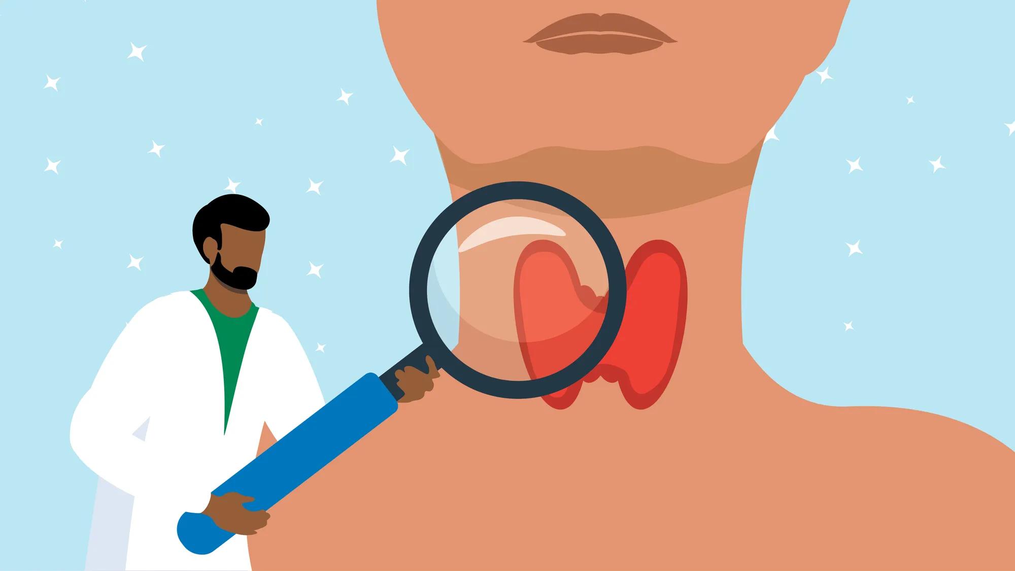 is glutathione good for hyperthyroidism Understanding Hypothyroidism: Diagnosis and Treatment main image 1