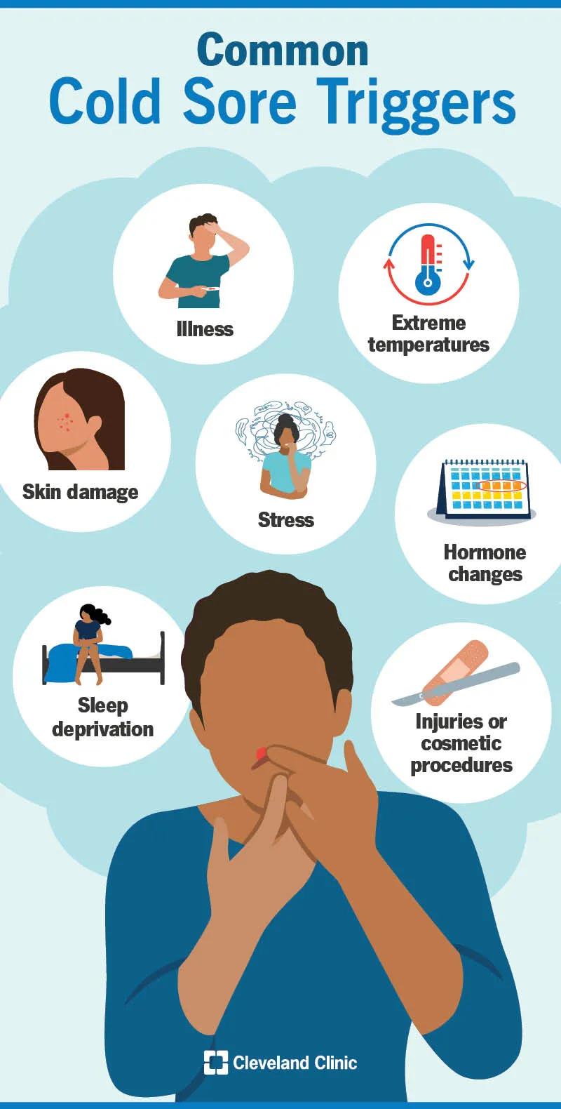 Common cold sore triggers