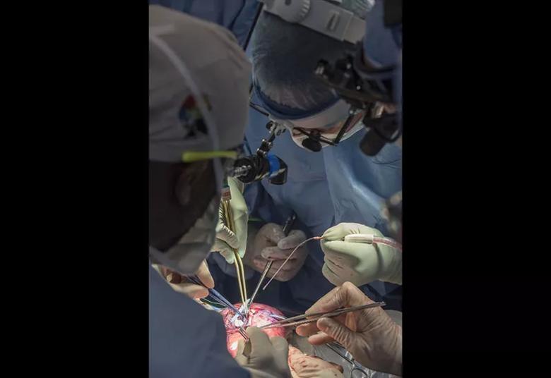 Surgeons work on the multi-layer, myofascial closure of the myelomeningocele defect.