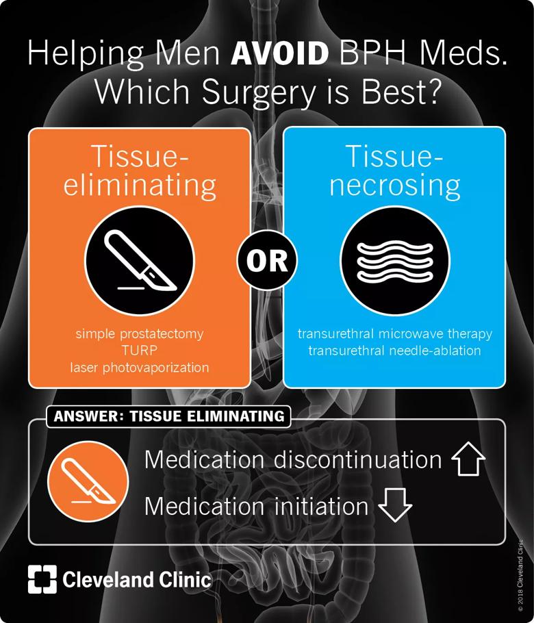 Benign prostate enlargement (BPH) surgical procedure.