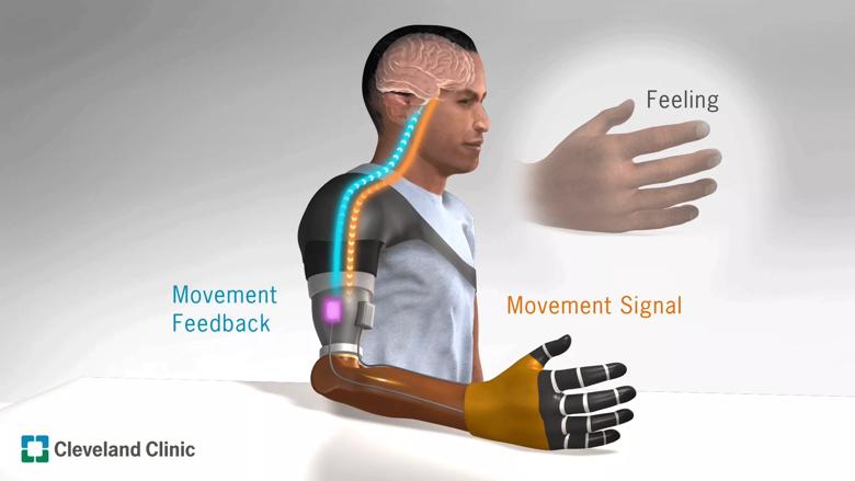 Cleveland Clinic research prosthetic arm