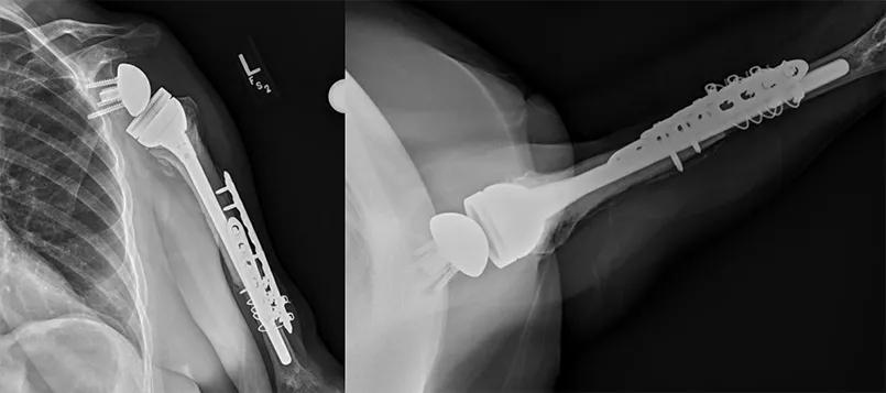 X-rays