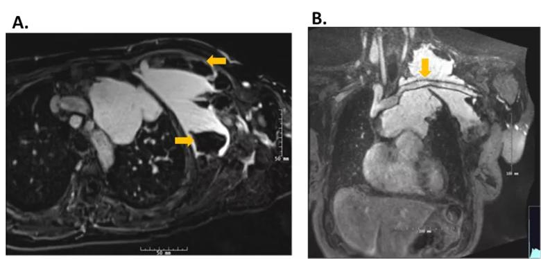 Figure 2. Magnetic resonance angiography.