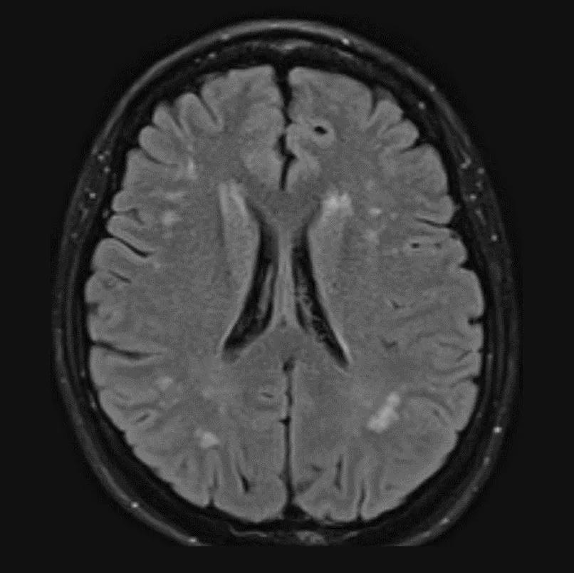 Brain scan