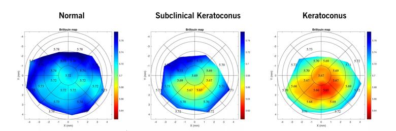 3 concentric circles with areas marked in different colors: blue, green and yellow