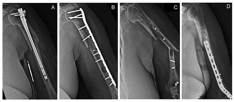 Radiographic diary of surgeries