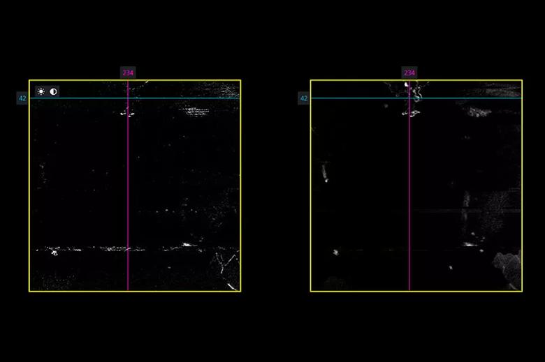 En face imaging of the vitreoretinal interface slab 