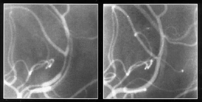 16-RHE-871-Calabrese-Inset-Image-650pxl-width