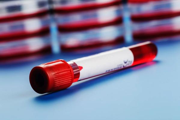 Blood sample in a tube on a blue table