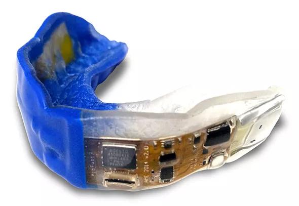 Cleveland-Clinic-Intelligent-Mouthguard
