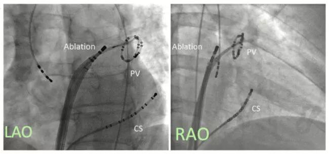 Image-1-Fluoroscopy