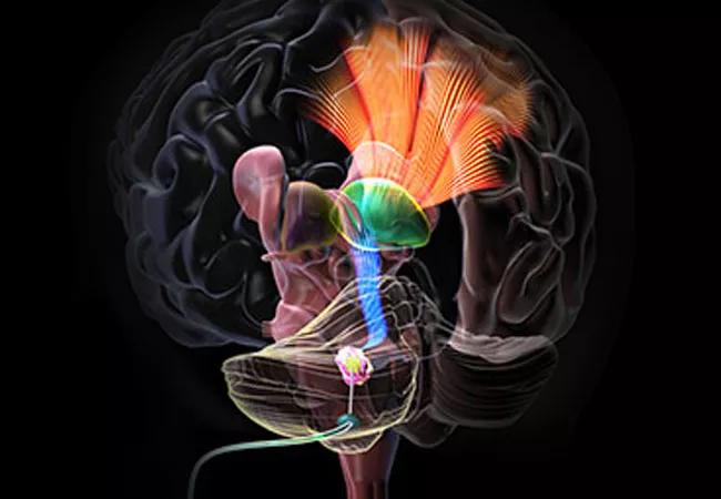 Could DBS of the Cerebellar Dentate Nucleus Enhance Post-TBI