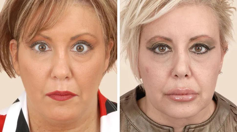 Front View - Before and After