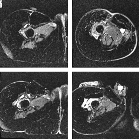 Intraoperative-MRI-Suite_Figs 1-4_Joyce