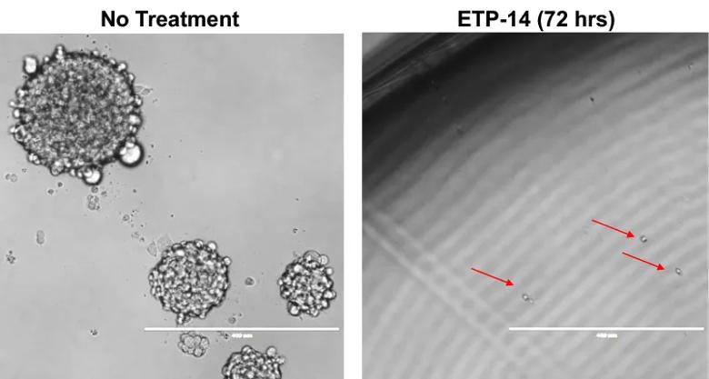 Epigenetic targeting against pediatric high-grade glioma