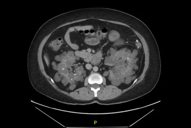 Uribina CT_Figure 3
