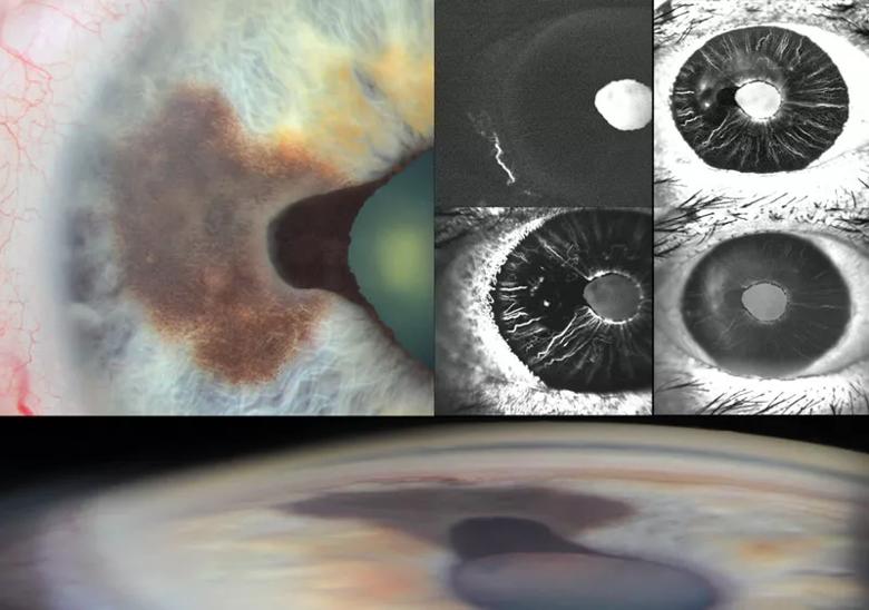 Various angles of the inside of an eye