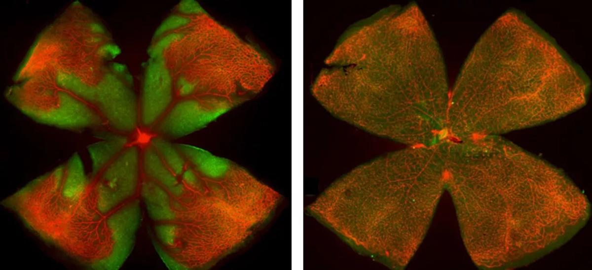 Fluorescent images of retinal flatmounts produced from littermate pups in the mouse oxygen retinopathy model
