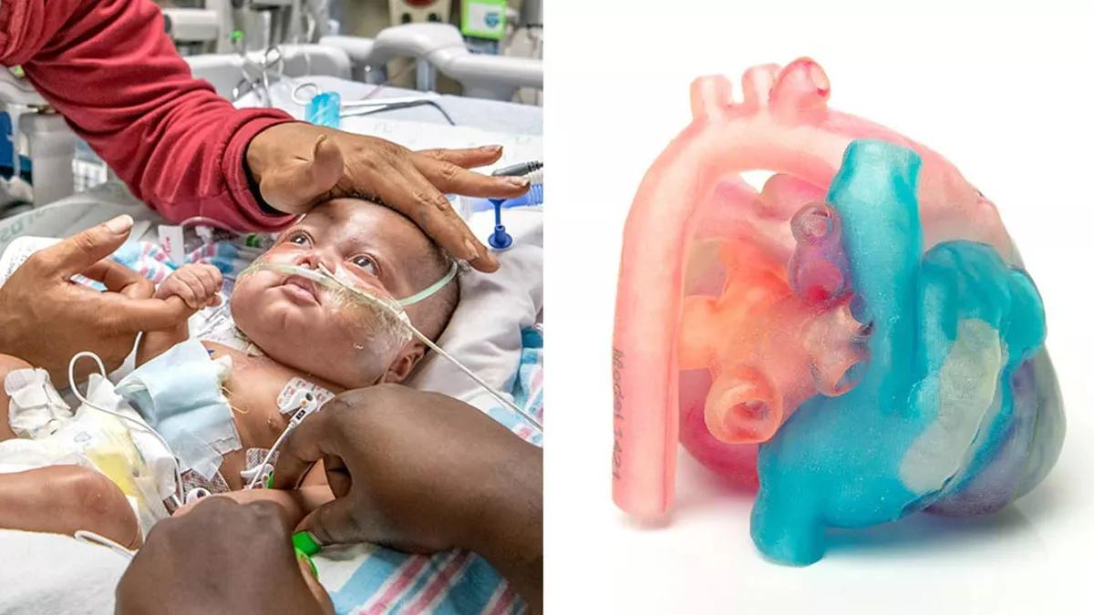 健康・医学 Surgery for congenital heart defects Amazon | Surgery for Congenital Heart Defects | Stark, J., De
