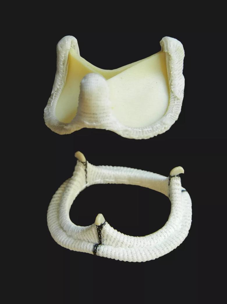 Smaller (inset) image