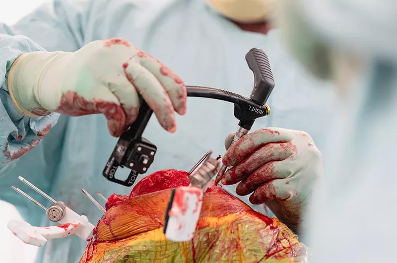 Surgeon using probe during knee surgery